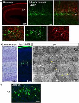 Subplate Neurons as an Organizer of Mammalian Neocortical Development